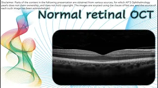 OCT 2 | Normal retinal OCT