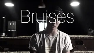 Bruises - Lewis Capaldi (abridged cover)