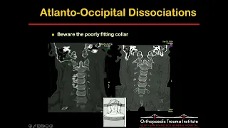 Evaluation and Treatment of the Pediatric Spine Trauma Patient - Ashraf El Naga, MD