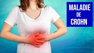 Maladie de Crohn : Symptômes et Traitements