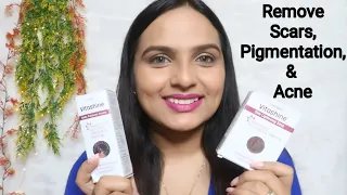 Vitashine Daily Cream & Soap Review | Remove Pigmentation,Scars&Acne Marks| Glam your face