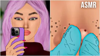 ASMR Satisfying blackheads removal | Squeeze Huge Nose Pimple | Beauty ASMR Animation