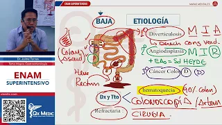 MAPAS MENTALES - HEMORRAGIA DIGESTIVA