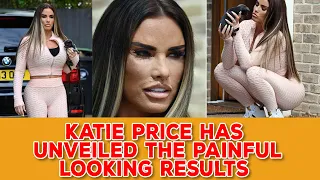 Katie Price's scarred face seen unfiltered for first time after 'fox eye' facelift