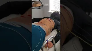 My husband first time getting Acupuncture I tried not to laugh