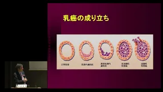 【Japan Cancer Forum2018】乳がん　～初期治療と再発治療、最新情報～