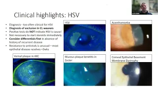 Feb 2024   Cornea   Mr Scott Robbie