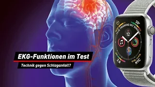 EKG-Funktionen im Test: Warnung vor Schlaganfall?