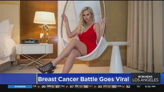 Breast cancer survivor's story goes viral