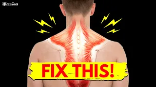 How to Fix Traps and Shoulder Pain in 30 SECONDS