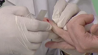 Экспресс-тест на ВИЧ-инфекцию
