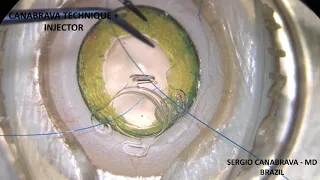 Canabrava 4 Flanged Technique + Injector