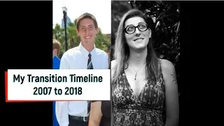 Male to Female (MTF) Transgender Transition Timeline | 4 Year Timeline