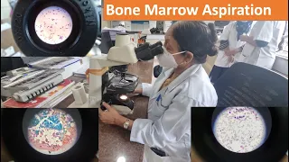 Bone Marrow Study II Bone marrow Examination