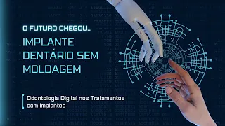 Implantes Dentários e a Odontologia Digital