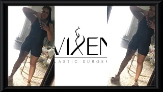 NEW BODY VLOG EP:1 | LIPO 360/BBL JOURNEY | VIXEN PLASTIC SURGERY