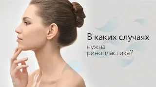 В каких случаях нужна ринопластика?