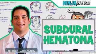 Subdural Hematoma | Anatomy, Etiology, Pathophysiology, Clinical Features, Treatment