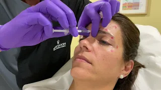 Tratamiento de Botox by Dr. Daniel Salvador