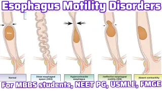 Esophageal Motility Disorder For MBBS students, Neet PG, Usmle, FMGE I Neet PG Usmle Preparation