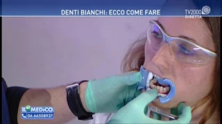 Il mio medico - Sbiancamento dei denti