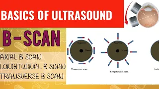 #2 B SCAN COURSE|| AXIAL, LONGITUDINAL & TRANSVERSE B-SCAN || TOPOGRAPHIC, KINETIC B-SCAN.||