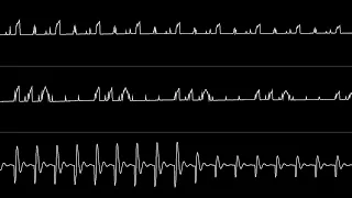 Jammer - "Peyotl" (C64) [Oscilloscope View]