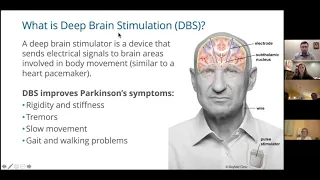 Updates in Deep Brain Stimulation for Parkinson's and Exercise Considerations