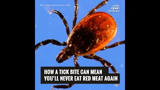 Alpha-Gal Syndrome: The Tick-Borne Disease That Makes You Allergic to Red Meat
