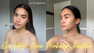 natural everyday acne makeup routine (for acne, textured skin & post inflammatory pigmentation)