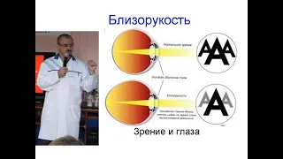 Близорукость. Спазм аккомодации. Минусовые очки.