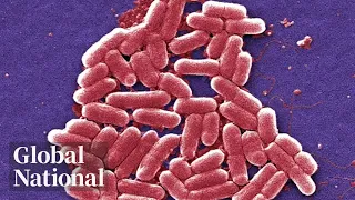 Global National: Sep. 7, 2023 | Fear, anger among Calgary parents over E. coli outbreak