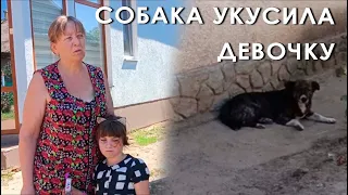 Собака укусила девочку