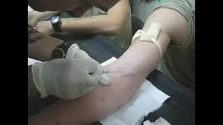 Afraid of Needles