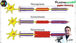 Plasticology - Nerve Injuries Classifications Tips & Tricks