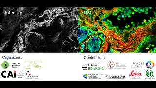 Lecture 10: Simultaneous Metabolic FLIM and Oxygen PLIM in Biomedical Research