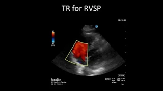 Principles of Doppler Ultrasound