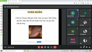 VIÊM GAN B & VIÊM GAN C  || BÀI GIẢNG CK1 NỘI Y HÀ NỘI