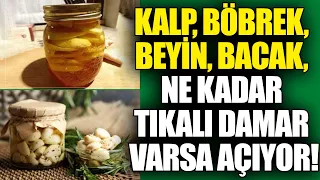 Kalp, Böbrek, Beyin, Bacak, Ne Kadar Tıkalı Damar varsa Açıyor!