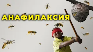 Анафилаксия (анафилактический шок) #ПроСМП