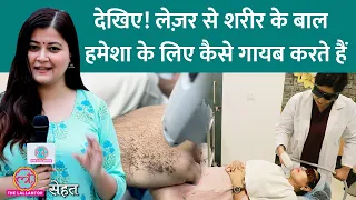 कैसे होता है Laser Hair Reduction जिसमें Body Hair जड़ से खत्म होते हैं | Sehat ep 594