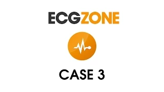 ECG Case 3 - Collapse