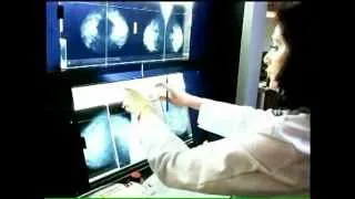 What is Molecular Breast Imaging (MBI)? Physician's Prospective : Early detection of Breast Cancer