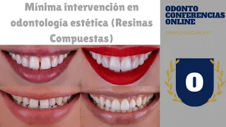 Mínima intervención en odontología estética (Resinas Compuestas) por el Dr. Fritz Espejo