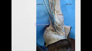 Distal Nerves of Thoracic Limb, Equine & Bovine