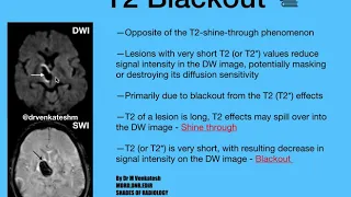 T2 blackout Phenomenon