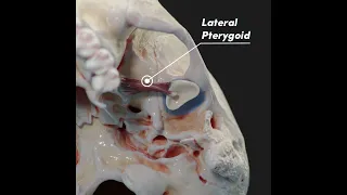 Temporomandibular joint (TMJ) and its articular disc