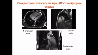 Рыжков А.В. «Возможности  МРТ в диагностике легочной гипертензии»