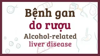 Bệnh gan do rượu - nguyên nhân, triệu chứng & bệnh lý