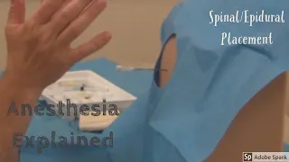 Spinal Epidural Placement